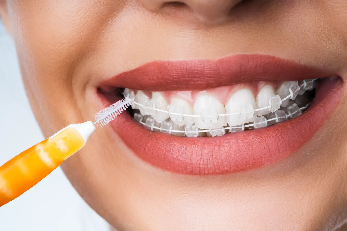 Protetyka stomatologiczna Lublin