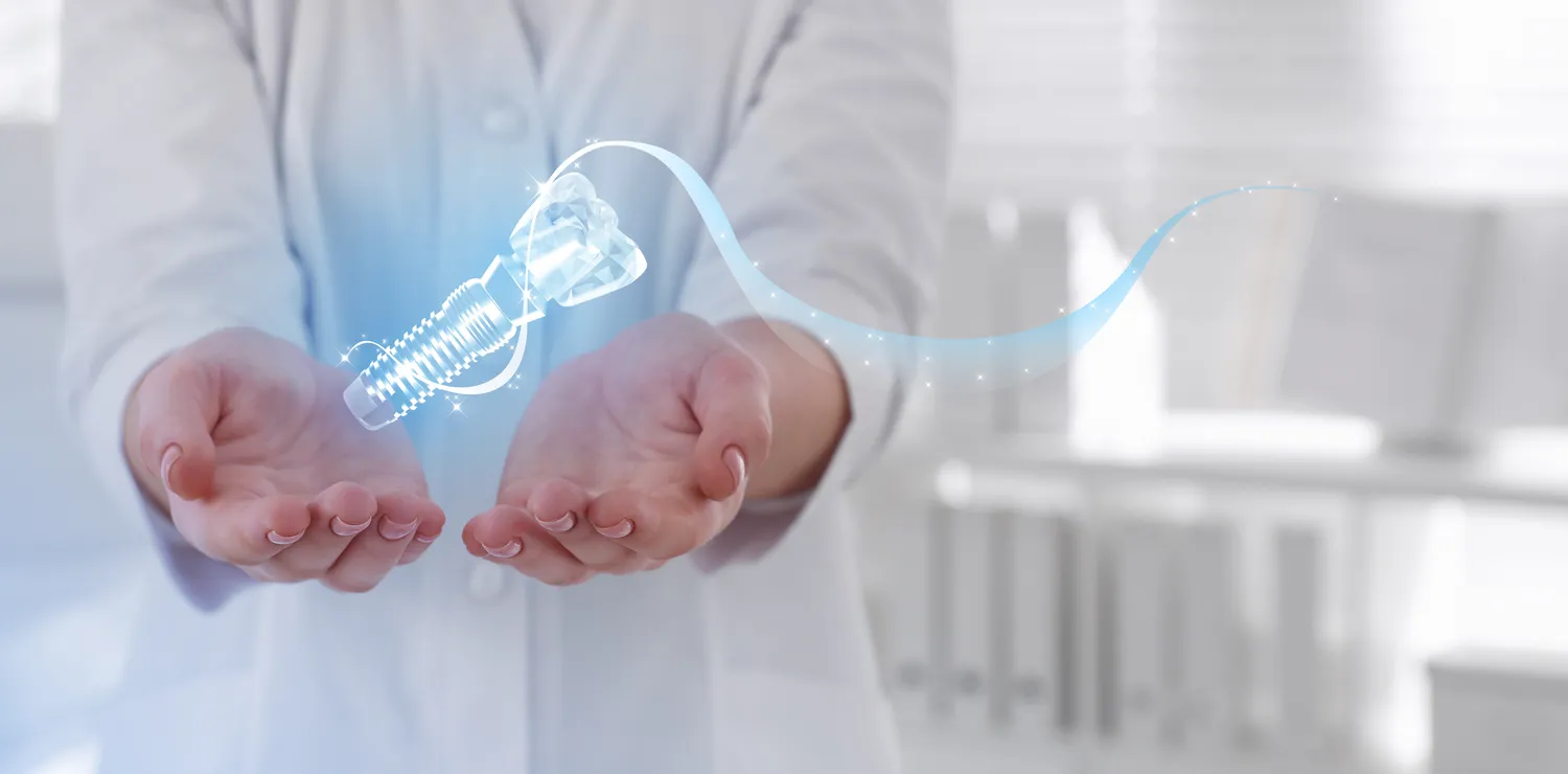 Jak długo wytrzymują implanty zębów?