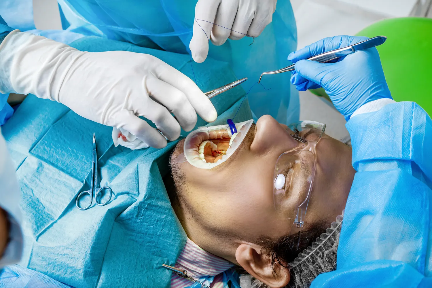 Powiększanie ust Lublin gdzie najlepiej?