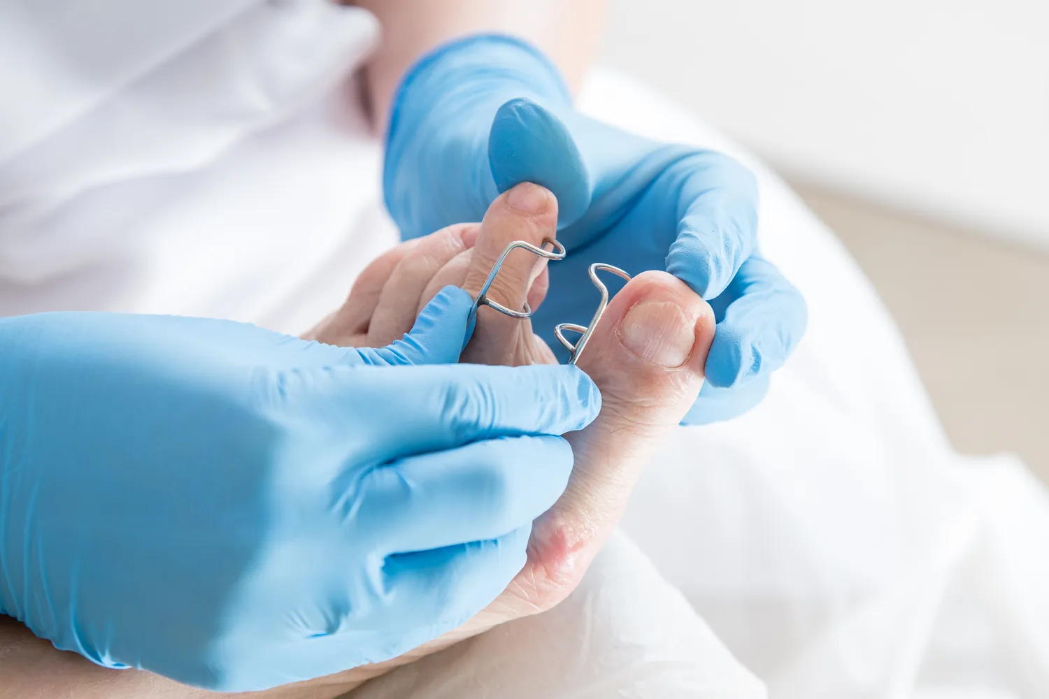  Opatrunki ze srebrem jak zakładać?