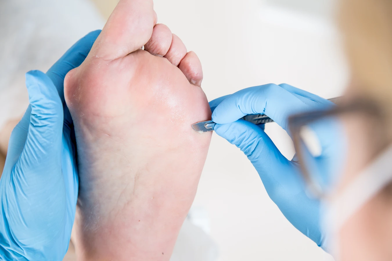 Co warto wiedzieć o leczniczym pedicure?