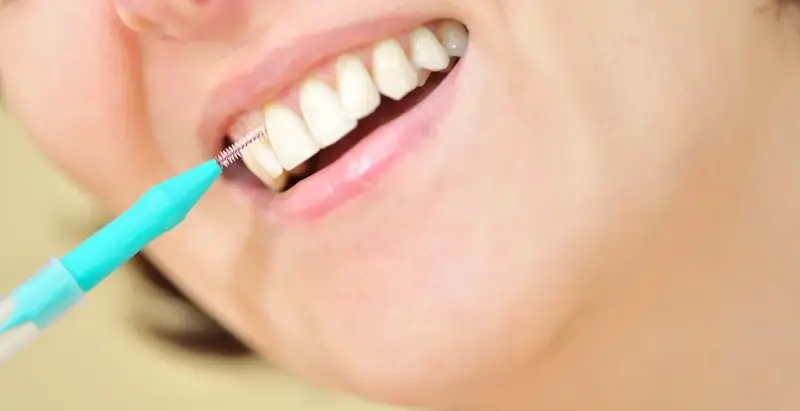 Implanty zębów Szczecin gdzie najlepiej