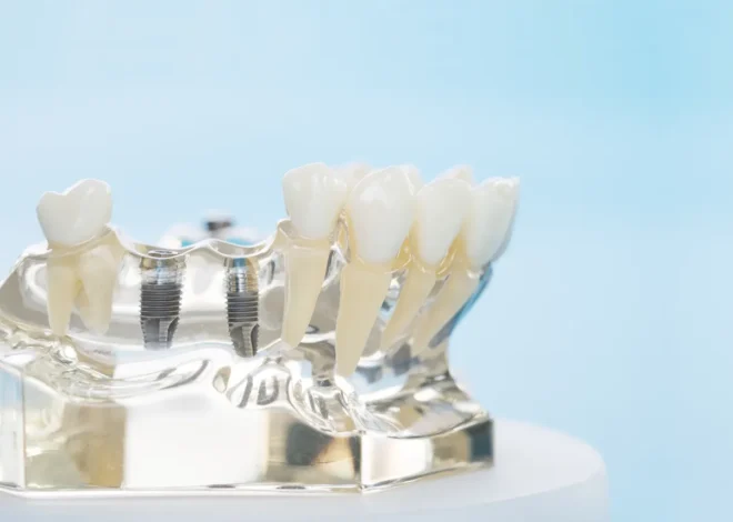 Leczenie kanałowe Warszawa gdzie najlepiej