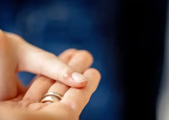 Co zrobić na kurzajki?