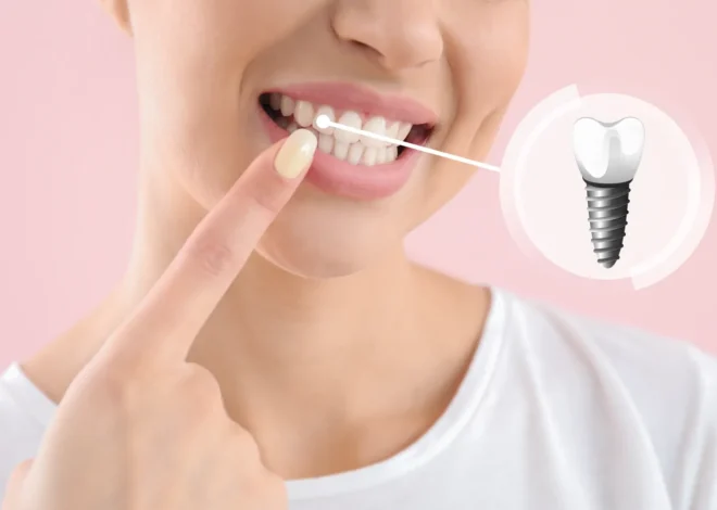 Implanty w jeden dzień Police