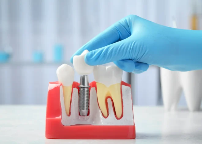 Implanty w jeden dzień Szczecin