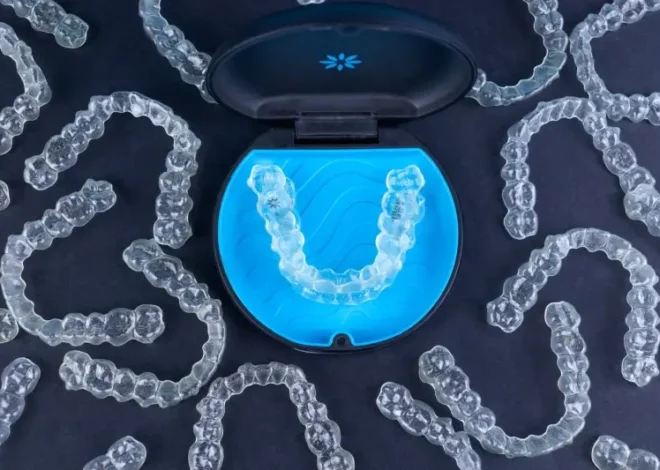 Nakładki Invisalign czy warto?