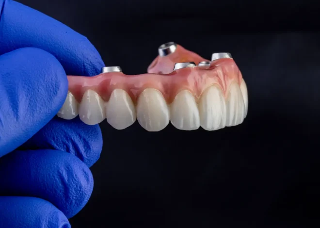 Zęby w jeden dzień Kołobrzeg