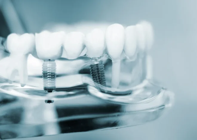 Zęby w jeden dzień Świnoujście