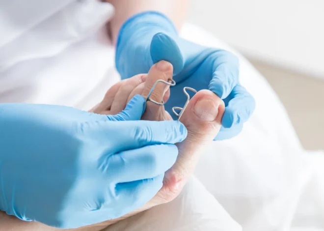 Czym jest podologia oraz czym dokładnie zajmuje się podolog?